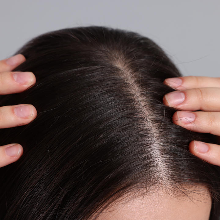 5 Steps to Achieve a Healthy Scalp