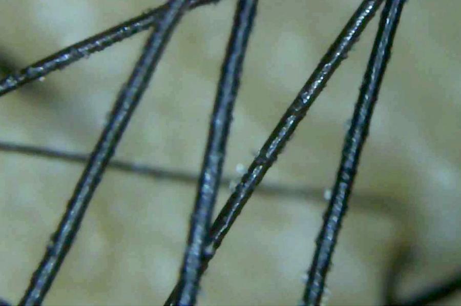 Scalp camera view after the Day After™ Brush: clean dark strands with a clear scalp